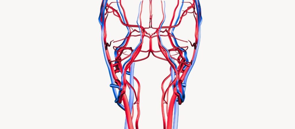 תסמונת גודש אגני (Pelvic Congestion Syndrome) גורם אפשרי לכאבי אגן כרוניים אצל נשים